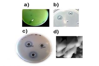 Biomoleculas bacterianas como bioinsecticidas y conservadores de alimentos 