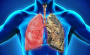 Contaminación y COVID-19: riesgo para la salud pulmonar de los mexicanos