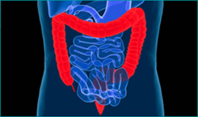 “El ABC del cáncer colorrectal”, un libro de medicina de precisión sobre este tipo de enfermedad