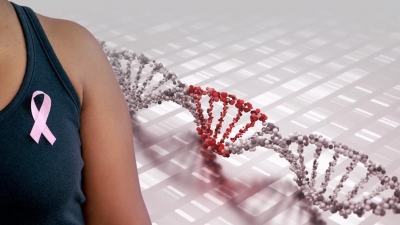 México registró casi 30 mil nuevos casos de cáncer de mama en 2020; el más mortal en mujeres