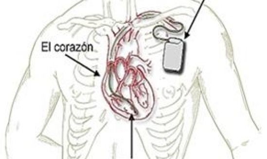 Tres dispositivos médicos innovadores para el tratamiento de cardiopatías