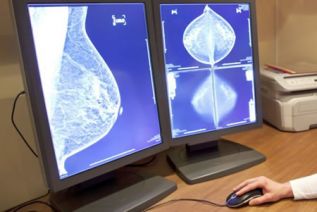 Educar para prevenir, en materia de cáncer de mama