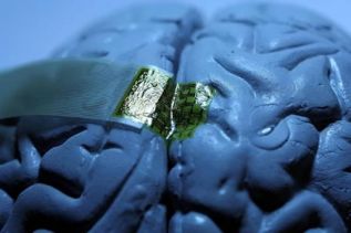 Estudia CINVESTAV uso de ultrasonido en novedoso implante cerbral