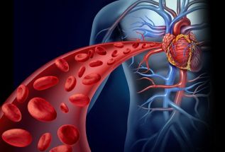 Alertan por alto riesgo de ataques cardiacos y eventos vasculares cerebrales en pacientes con Síndromes Coronarios Crónicos