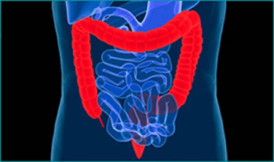 Dieta de mexicanos responsable del incremento del cáncer de colon