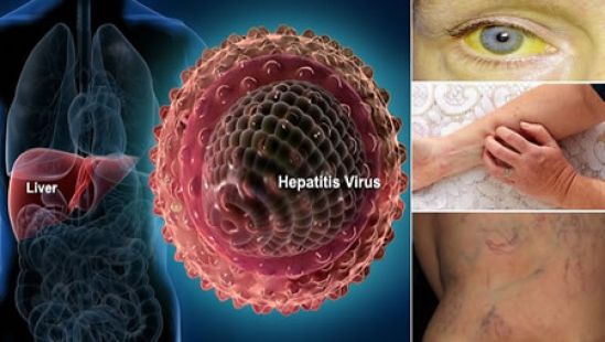 México de los países más infectados de hepatitis en los últimos años en América Latina