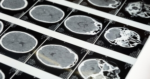 Los problemas de salud mental son poco comprendidos