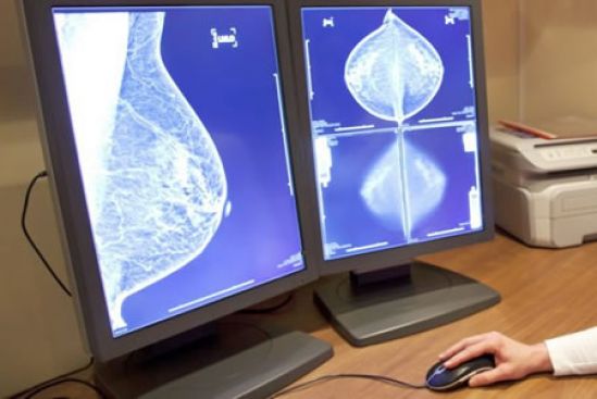 Mayor supervivencia global en cáncer de mama avanzado, según estudio MONALEESA-7