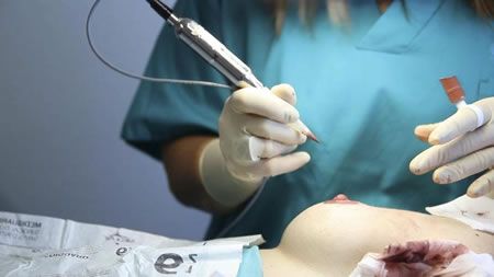 Nueva opción medicamentosa ayuda a reducir el tumor de cáncer de mama antes de la cirugía