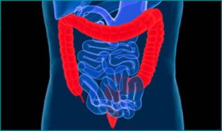 La vida de un paciente con cáncer colorrectal