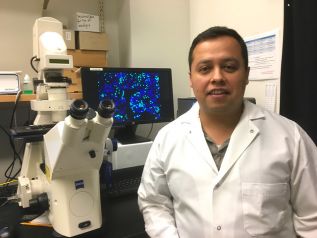 Una proteína epitelial podría cambiar en el futuro la forma de combatir el cáncer