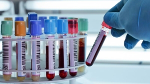 Disponibilidad y acceso en soluciones biotecnológicas para enfermedades del corazón