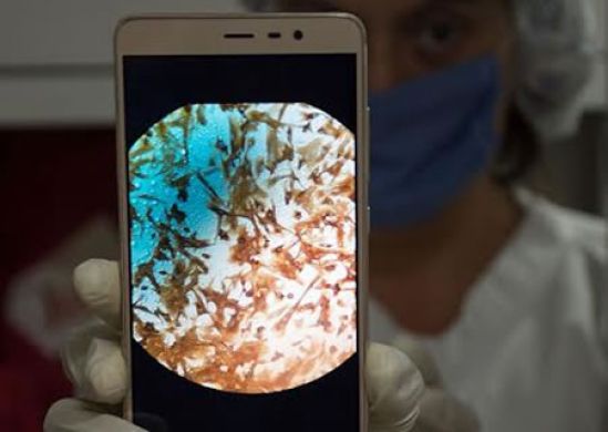 En el HIMFG se desarrolla técnica de regeneración celular para reconstrucción de vagina 