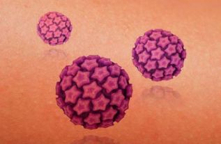 Mayo Clinic por una mejor detección del cáncer relacionado con el VPH