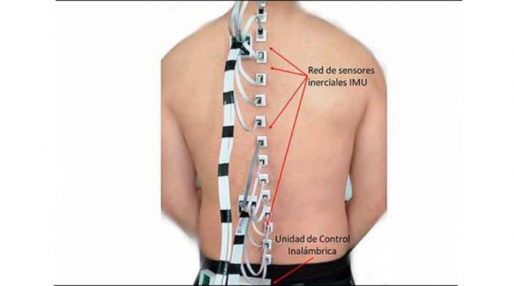 Diseña la UNAM sistema único en el mundo para monitorear movimiento de columna vertebral