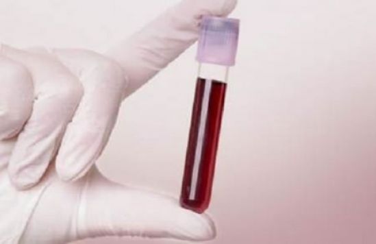 Buscan reducir errores en la toma de muestras sanguíneas para garantizar un diagnóstico preciso a los pacientes