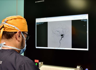 10 cosas que debes saber sobre el infarto cerebral
