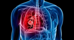 ¿Qué se debe priorizar, una vida más larga o una buena salud? Mayo Clinic responde